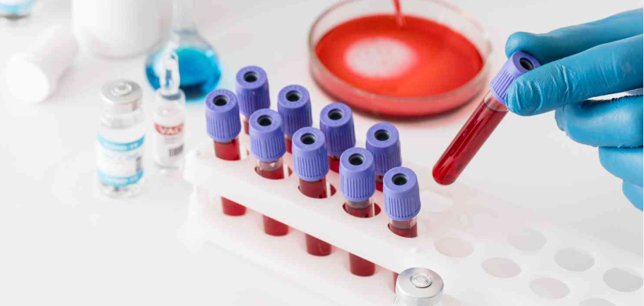 Utilizacion de tecnicas especificas para el diagnostico hematologico